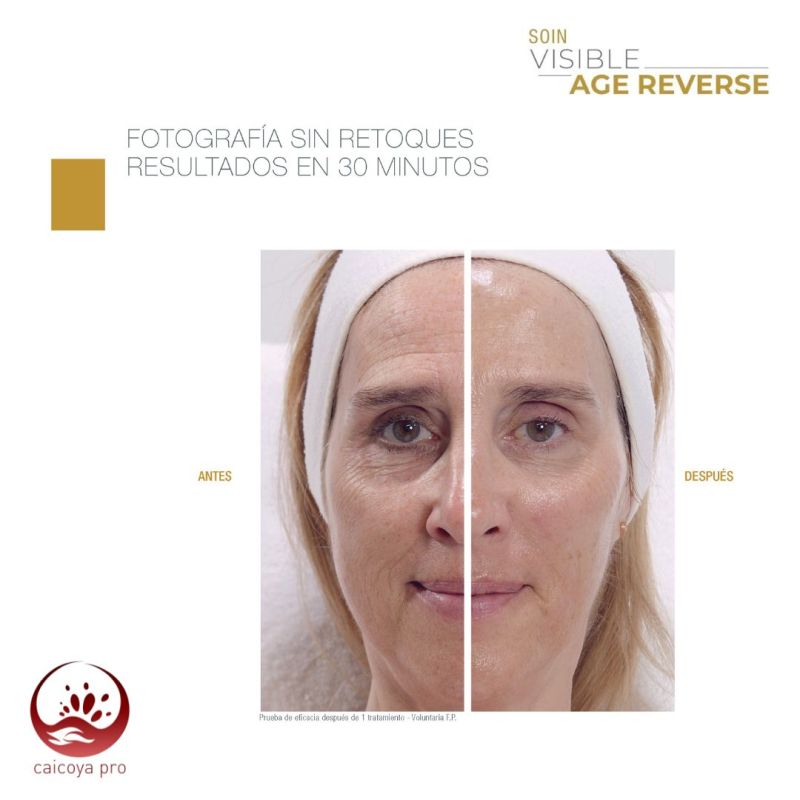 VAR & Linea Solar. Guinot