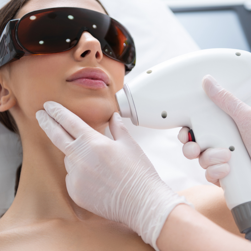 Curso Electro-epilación DRV